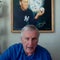 From 2024: Tommy John on Tommy John surgery, before and after