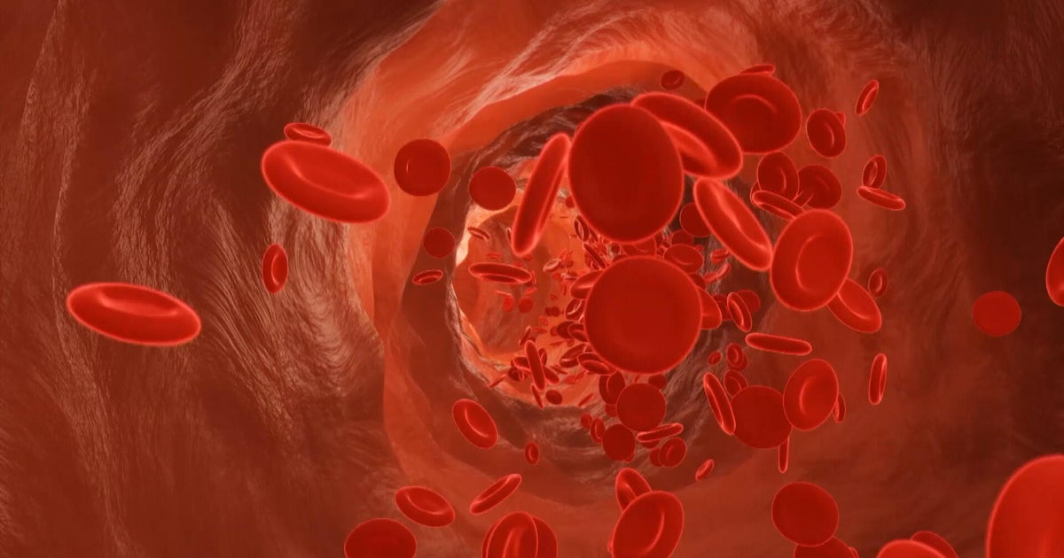 Clinical trial in Philadelphia gives new hope for rare blood cancer patient: 