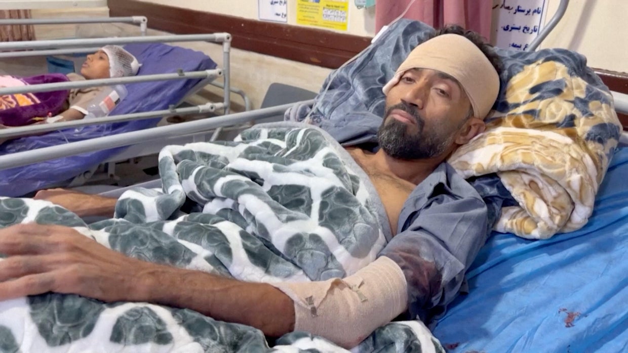 Victims lie in hospital beds after an attack on a wedding near Sirik, a coastal district near the Strait of Hormuz, on September 2, 2026; image taken from provided video footage.
