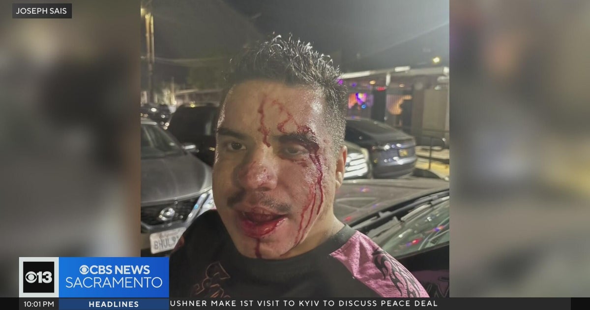 Sacramento man speaks out after attack in Lavender Heights