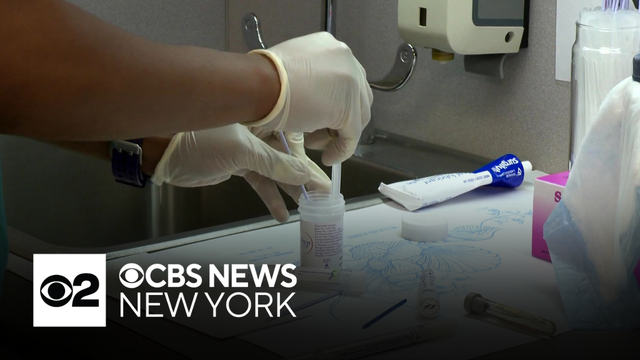 Cancer is leading cause of death among Hispanic, Latino community in U.S., report says