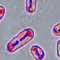 Medical experts on plague risks after reported death of lab worker in Russia