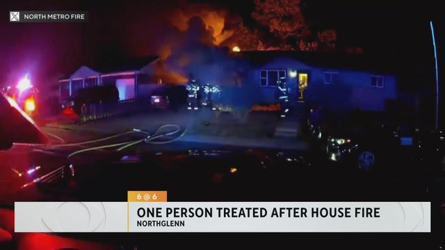 One person treated during house fire in Northglenn
