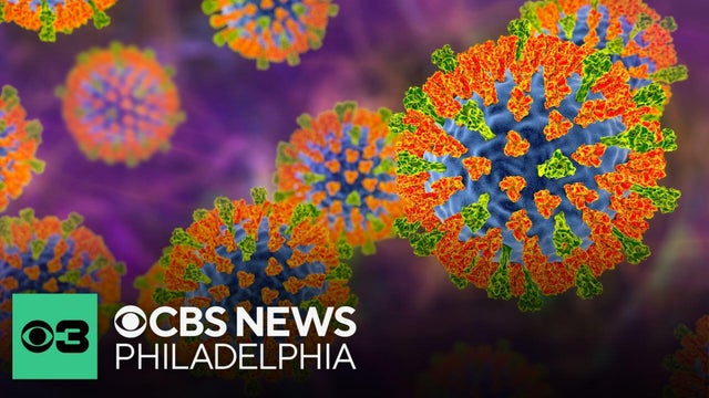 6th measles-associated death reported in Pennsylvania amid outbreak