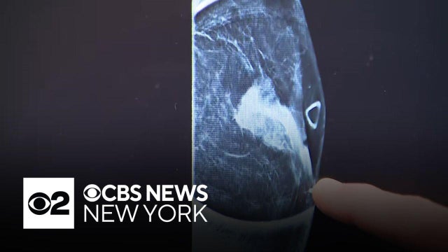 Male breast cancer survivor shares his journey