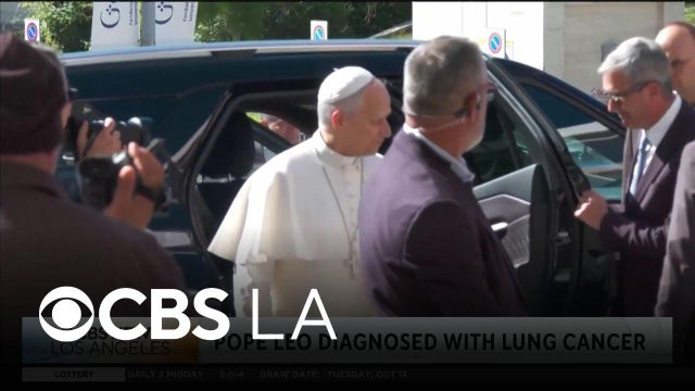Doctor discusses Pope Leo XIV lung cancer diagnoses