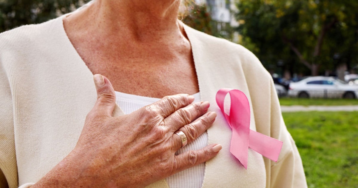 Doctor reacts to AI breast cancer tool
