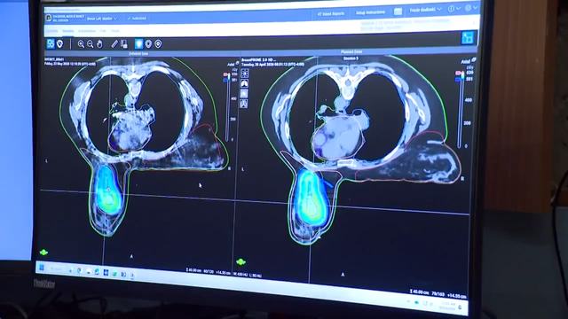 New technique uses artificial intelligence to fight breast cancer