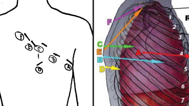 mullins-diagrams.jpg 