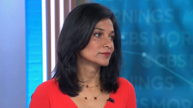 Neurologist on MS warning signs