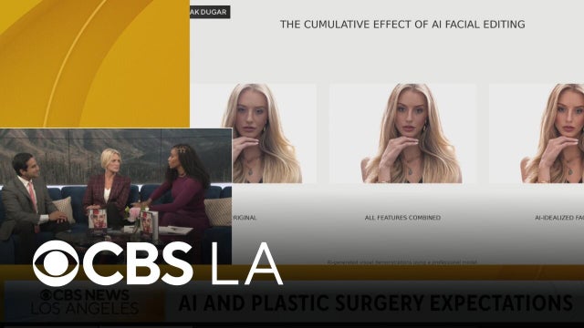AI-generated images create unrealistic plastic surgery expectations, surgeons say