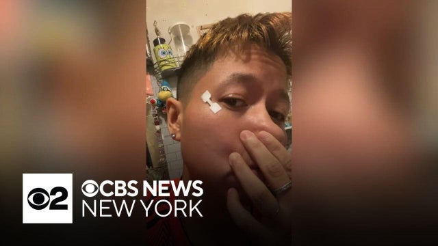 Bronx woman recounts harrowing weekend attack in Central Park