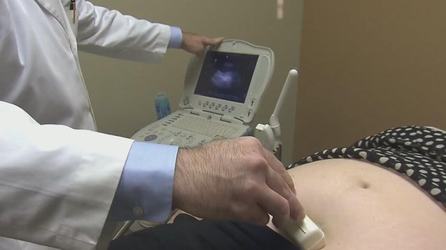 Stress can effect unborn babies' brains, study found