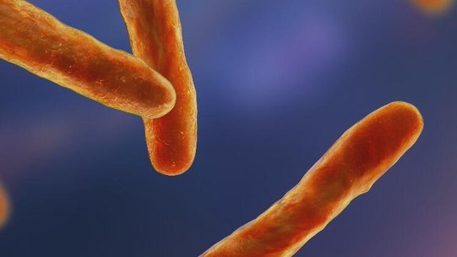 Bovine tuberculosis reported in Michigan