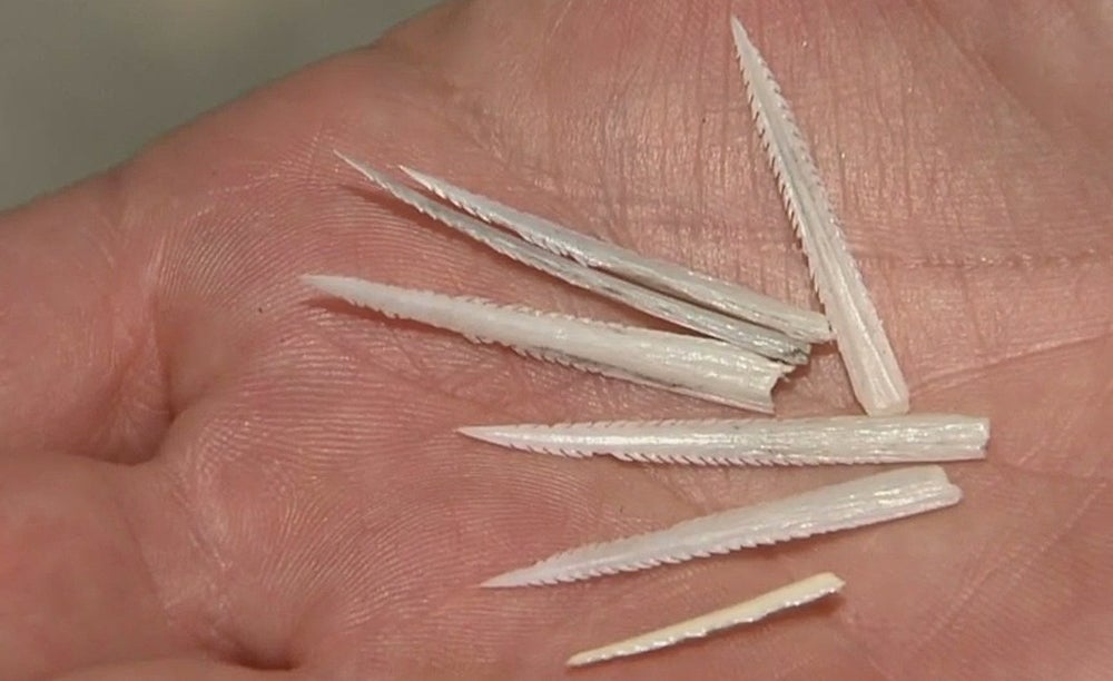 Dozens Treated For Stingray Injuries In Seal Beach CBS Los Angeles