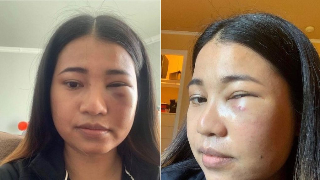 UPDATE: Asian Woman Assaulted Aboard BART Train In San Francisco - CBS ...