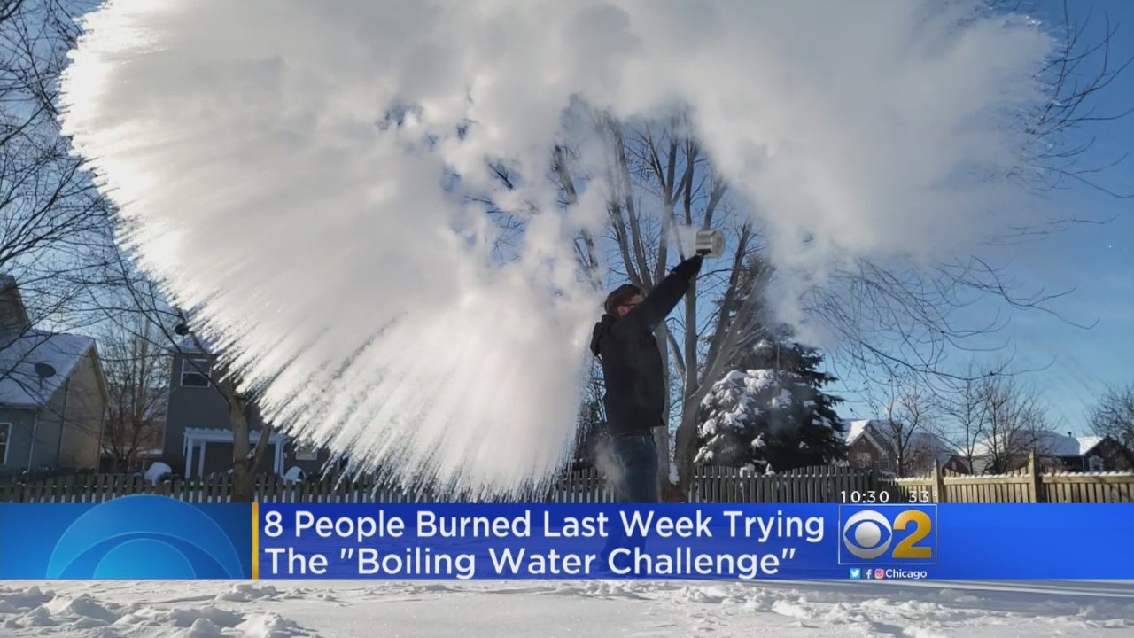 https://assets1.cbsnewsstatic.com/i/cbslocal/wp-content/uploads/sites/15116062/2019/02/boiling-water-challenge.jpg?w=300