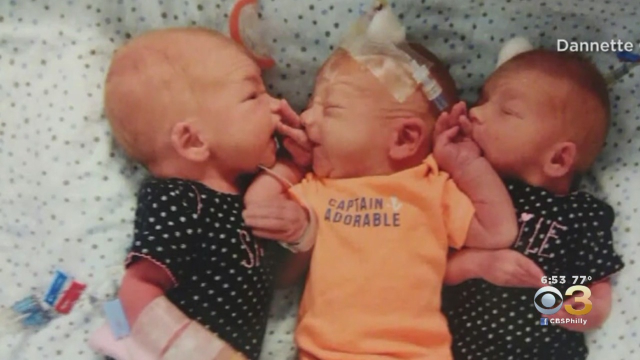 Woman Gives Birth To Surprise Triplets,Thought She Had Kidney Stones