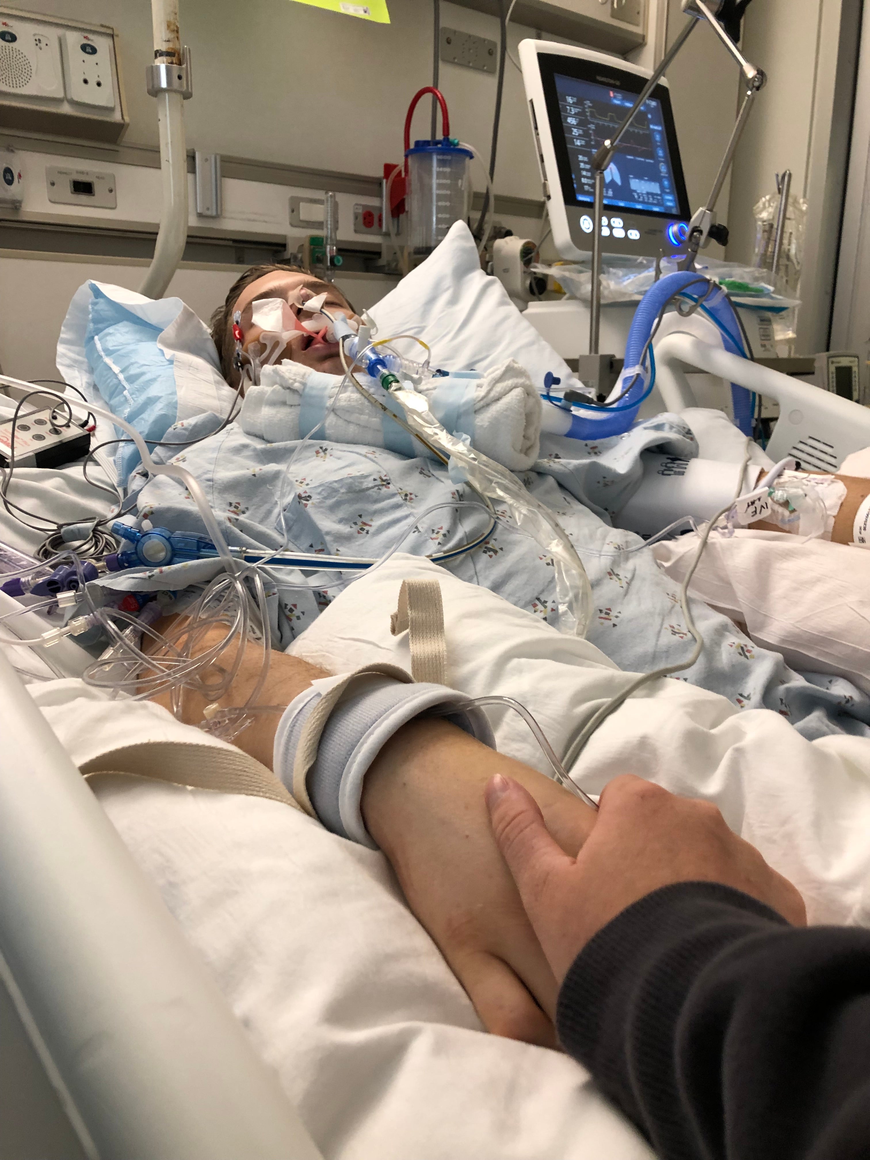 21-Year-Old In Coma For Complications Related To Vaping - CBS Sacramento